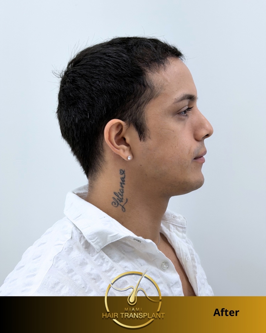 Case 1, additional angle 2