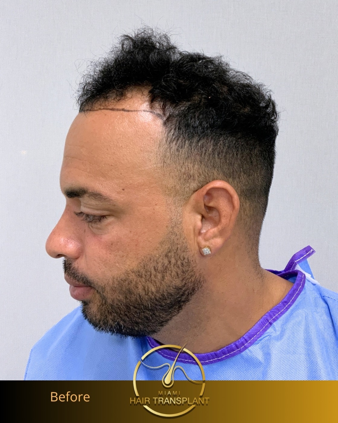 Case 2, additional angle 3