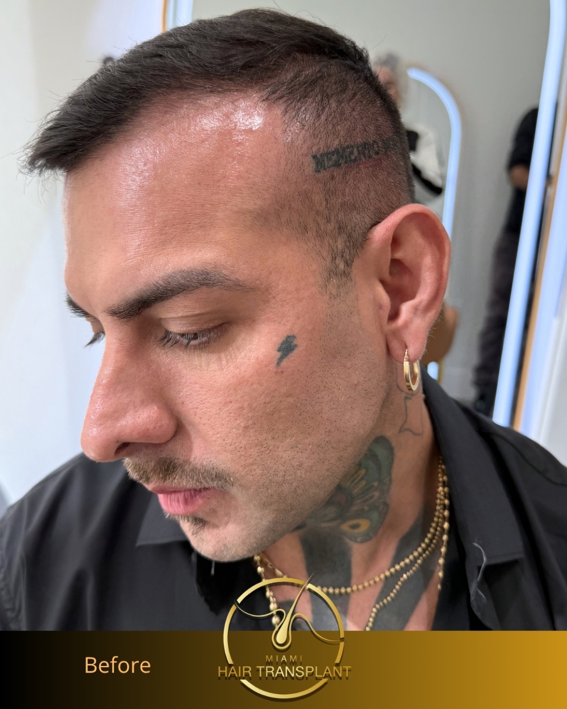 Case 3, additional angle 1