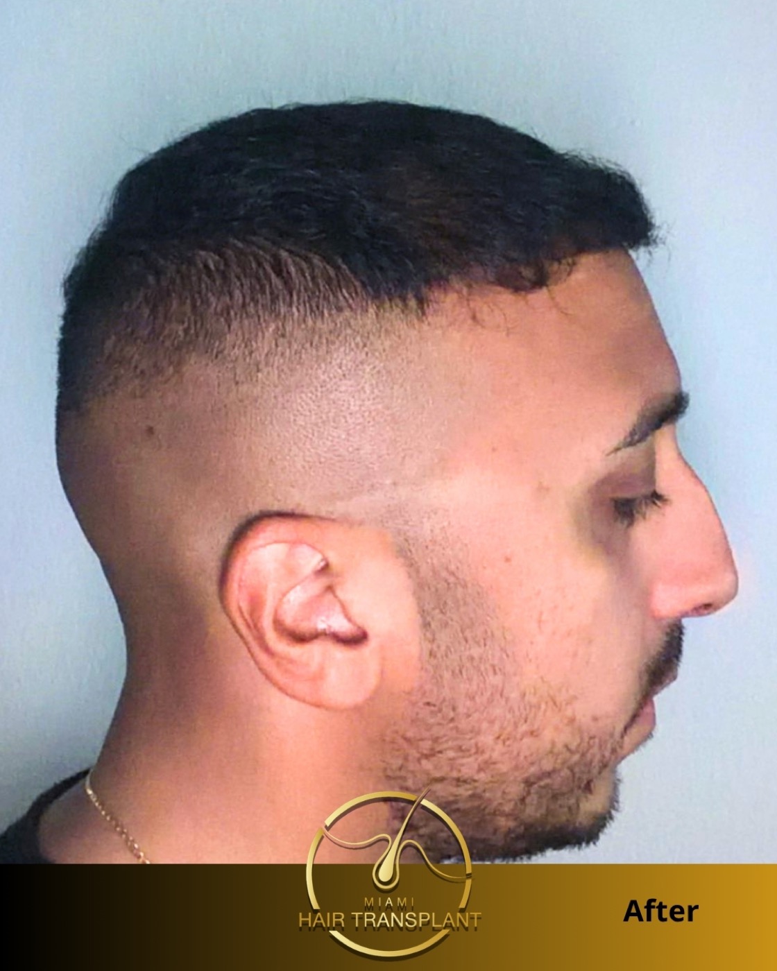 Case 5, additional angle 2