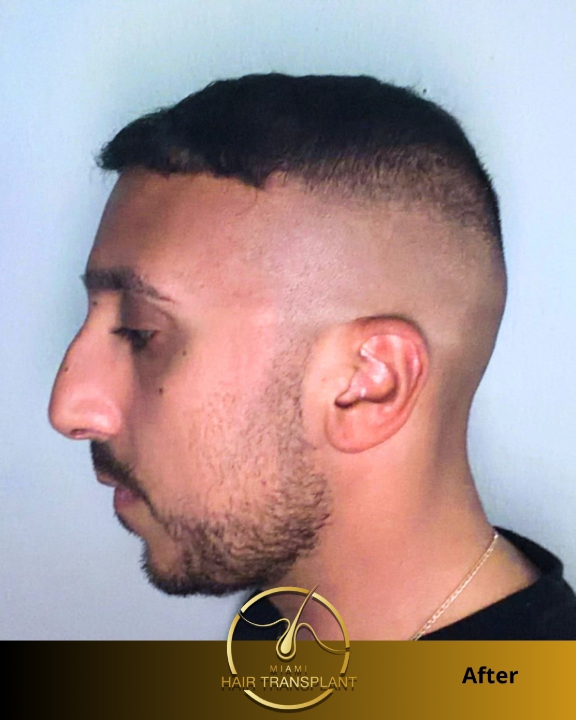 Case 5, additional angle 4