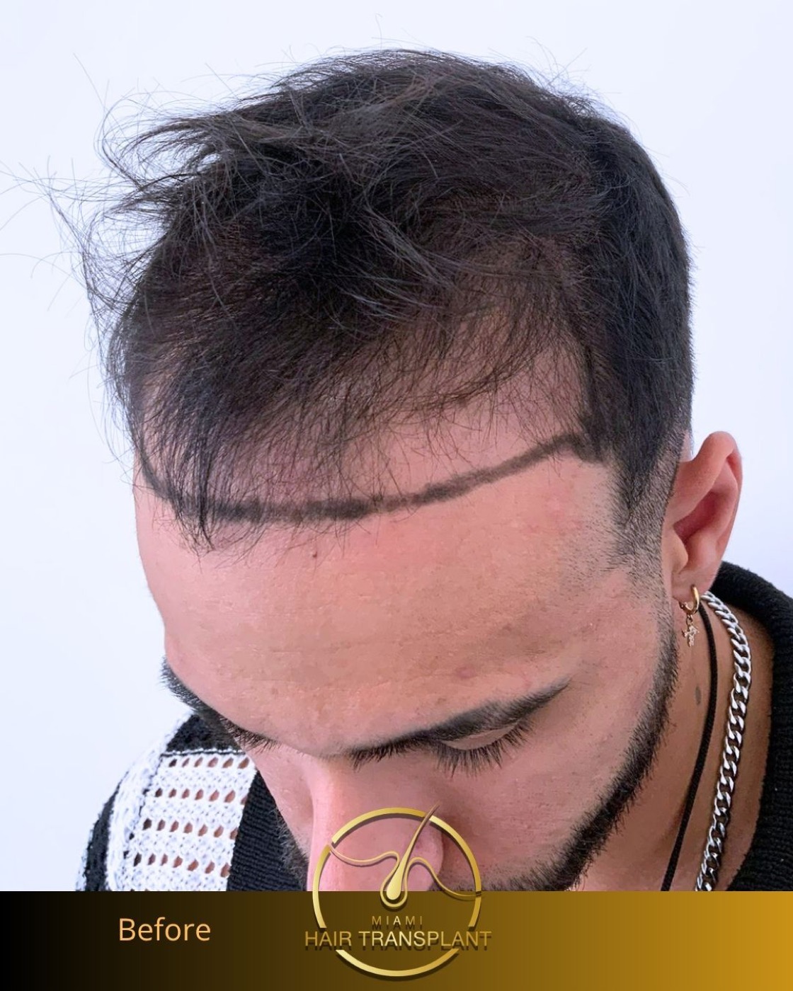 Case 6, additional angle 3