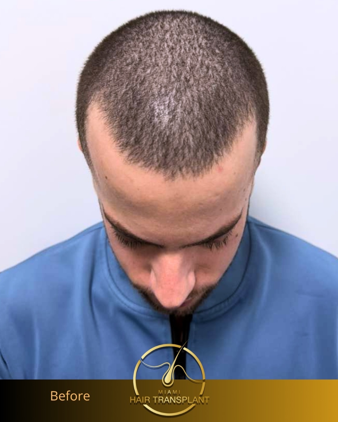 Case 8, additional angle 5