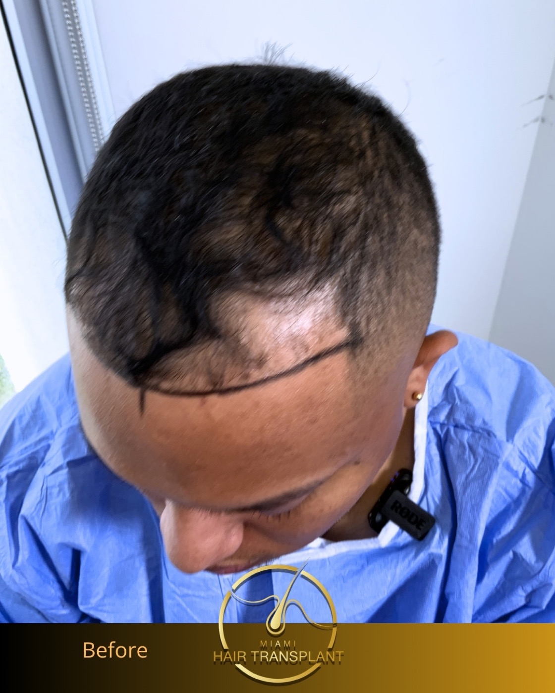 Case 15, additional angle 3