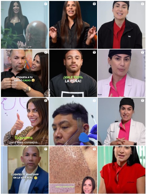 Miami Hair Transplant Instagram